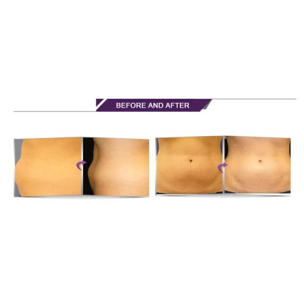 Beauty Salon Vacuum Cavitation System / Beauty Slimming Machine 6 Handles