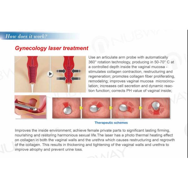 Fractional CO2 Laser Equipment Fractional CO2 Laser Skin Resurfacing
