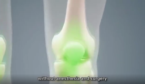 Noninvasive Mini Shockwave Therapy Devices For ED Therapy Machine 350W shockwave therapy for back pain