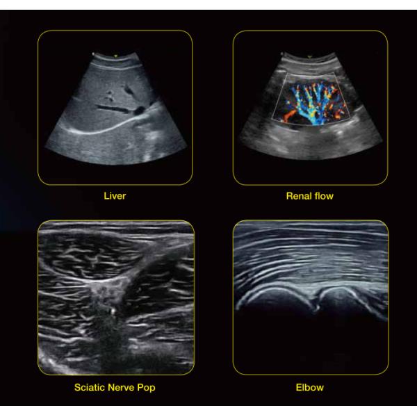 Color Ultrasound Machine Obstetrics And Gynecology Equipment 17MHz Linear Probe