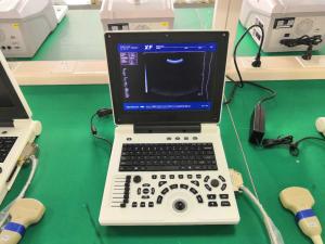12.1in Tech Diagnostic Ultrasound Scanner Machine Li Battery