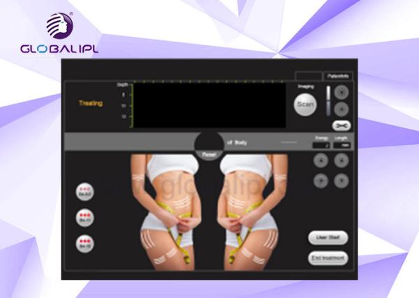 High Intensity Focused Ultrasound HIFU Machine 5 - 25mm Length For Face And Body