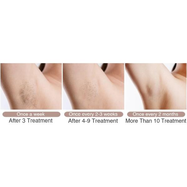 White 100-600ms 808 Diode Laser Hair Removal Beauty Machine