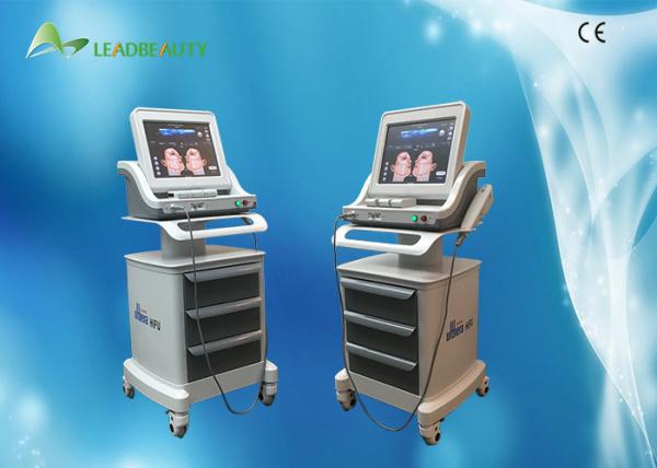 2016 New Three Cartridges Hifu Mini Portable Hifu Face Lift Skin Tightening