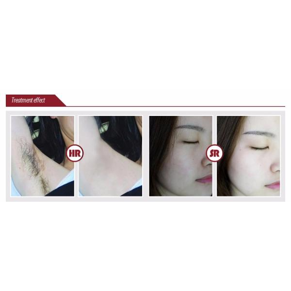 Home OPT SHR IPL Machine  Ipl for Skin Rejuvenation Device CE Approved