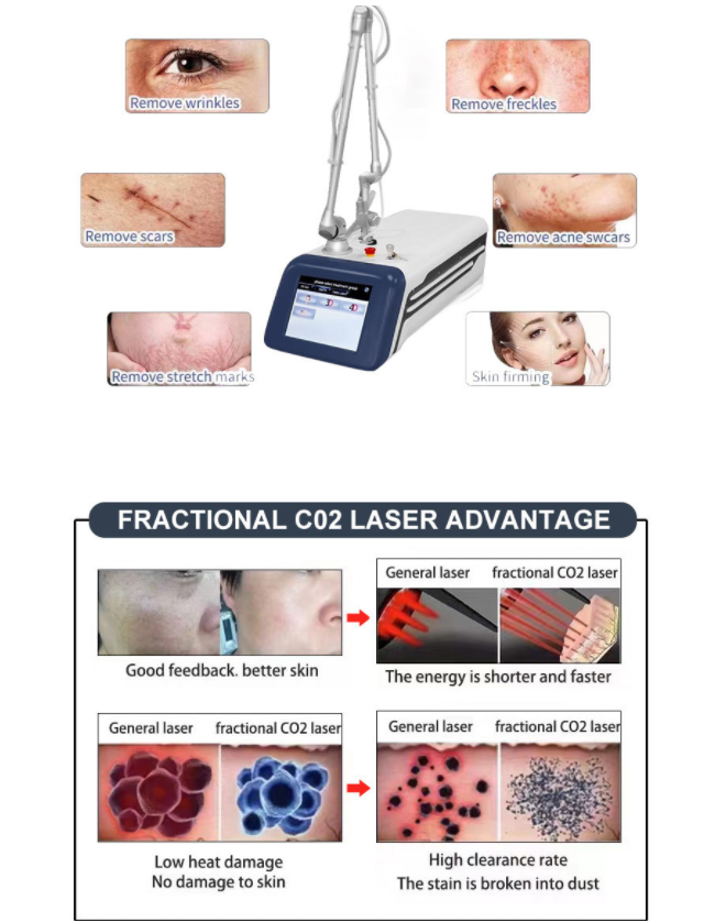 30W Fractional Co2 Laser Machine For Acne Scars Wrinkle Reduction