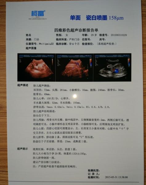 Single Side Printing 0.10Mm Laser X Ray Film For Hospital