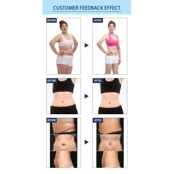 LF-251 Portable Mini Cryo Frozen Fat Machine Mini Cryotherapy Pad Frozen Freeze Slimming Cool Fat Machine