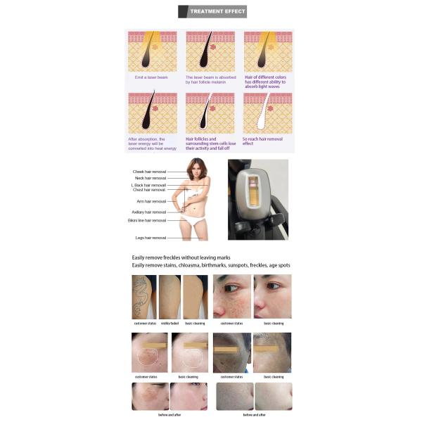 810 Pigment Removal Machine , Portable 2 In 1 IPL Beauty Laser Tattoo Removal Machine