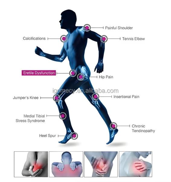 Appareils de physiothérapie par ultrasons