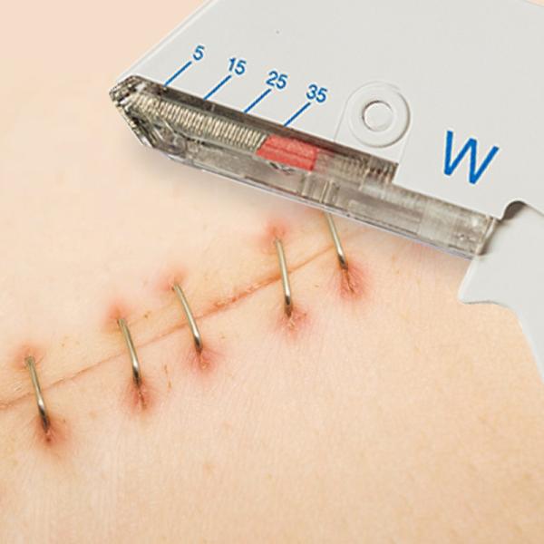Portable Sterile Disposable Skin Stapler For Vet Wound Closure