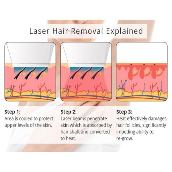 машина удаления волос 950nm IPL