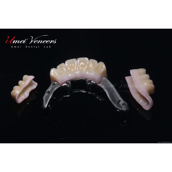 Sturdy zirconium oxide bridge frame