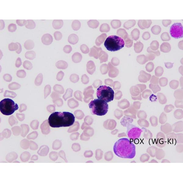 Método de oxidación de las manchas WG-KI