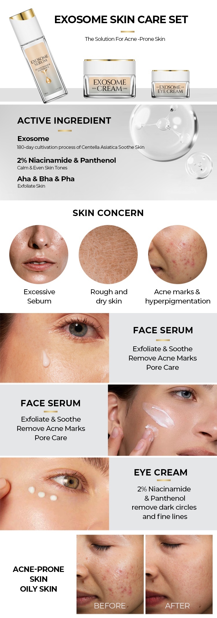 OEM ODM Korean Organic Natural Anti Aging and Anti Wrinkle Facial Skincare Serum Exosome Collagen Hyaluronic Acid Hyaluronic Acid Skincare Set