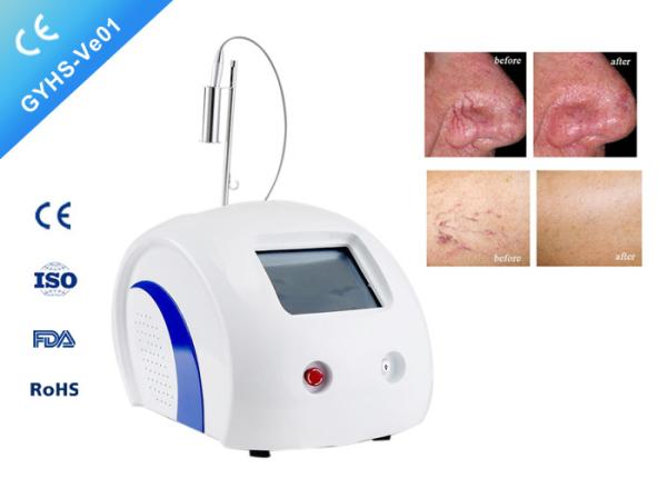 FDA Approved Laser Vein Removal Machine For Varicose Veins In Legs No Side Effects