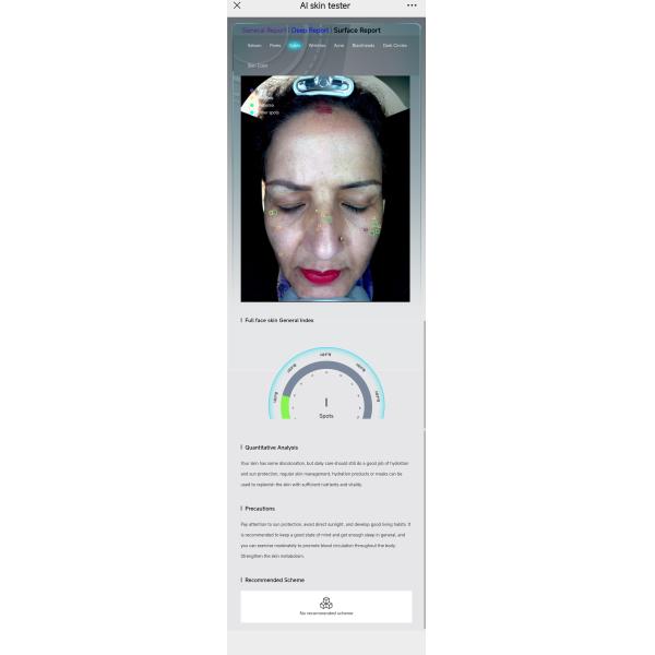 Skin Analyzer Reports Bitmoji Max Plus Facial Scanner Skin Scope Analysis Device
