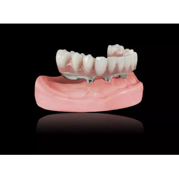 Implant Titanium Bar Removable Dentures Titanium Alloy Implant Bar Overdenture