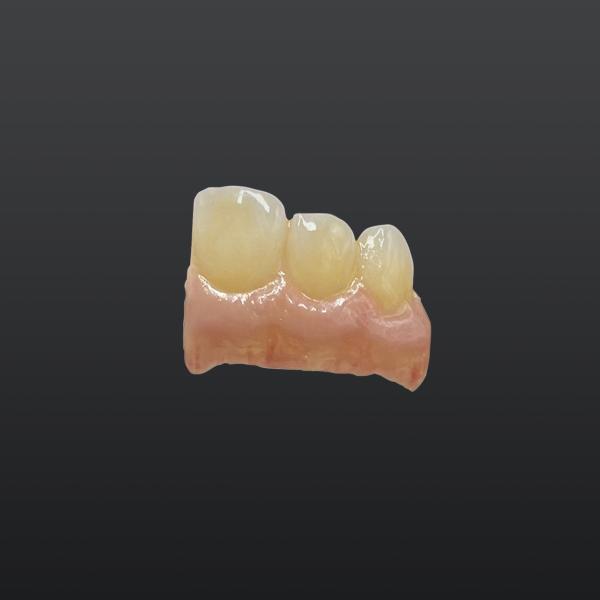 Various Quantities of Dental Materials in Various Colors and Performance