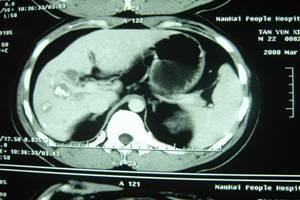 Custom Waterproof Medical Diagnostic Imaging X Ray Film For Thermal Printer