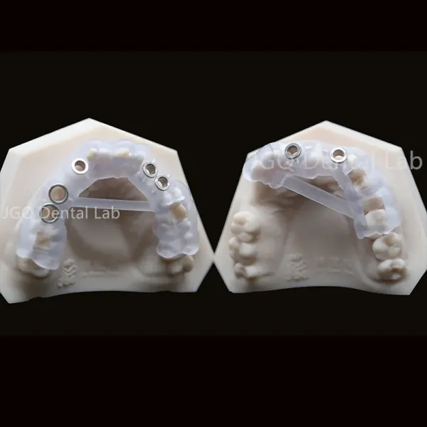 Customized Dental Crown and Bridge Porcelain Fused to Zirconia with CE FDA Certification and 3D Laser Printing