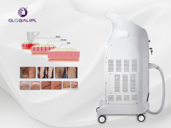 A melhor máquina da remoção do cabelo do laser do diodo do comprimento de onda da venda 755nm 808nm 1064nm três