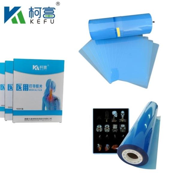 Medical Inkjet Printing Film Professional Production Medical Blue X Ray Film Laser Printing Medical X Ray Film