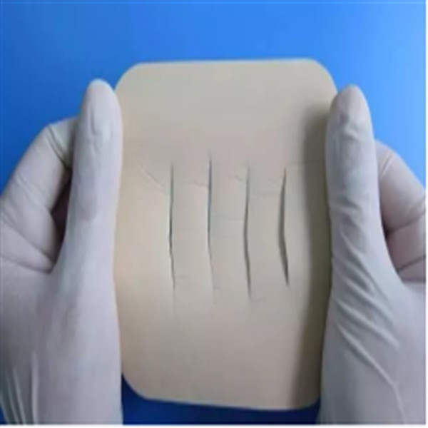 10*10cm White Flexible Foam Wound Dressing Adhesive Backing For Fast Recovery