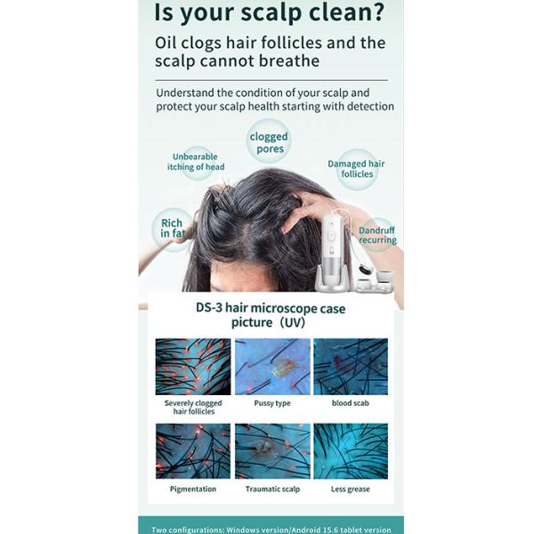 Hair And Scalp Analysis Machine , Skin Diagnosis Hair Analyzer Machine