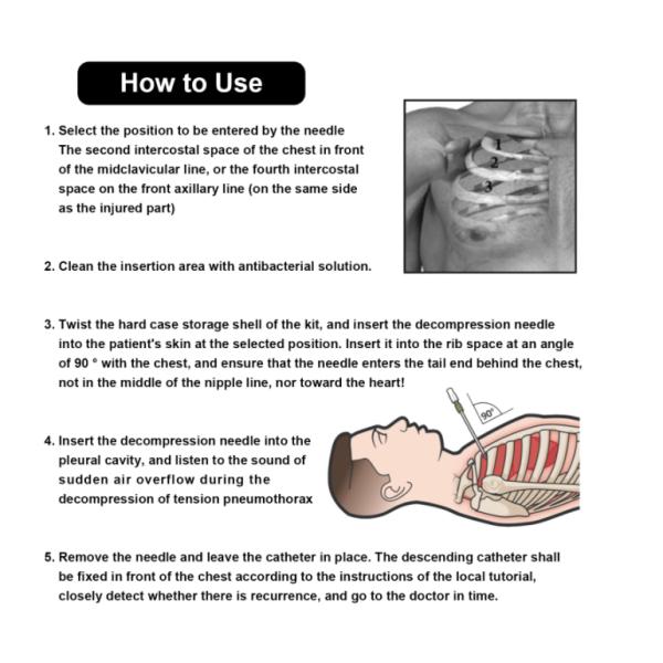 Pneumothorax Needle Chest Tension Cathether Needle trauma Decompensation Needle