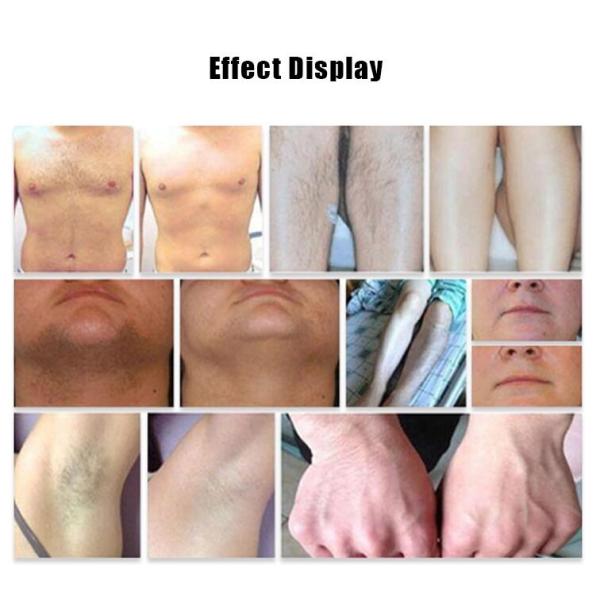 808nm Diode Laser Hair Removal Machine With 8.4 Inch Color Touch Screen