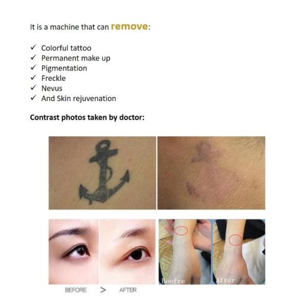 Стабилизированная точная обработка к переключила машину удаления татуировки лазера яг нд гарантия 1 года