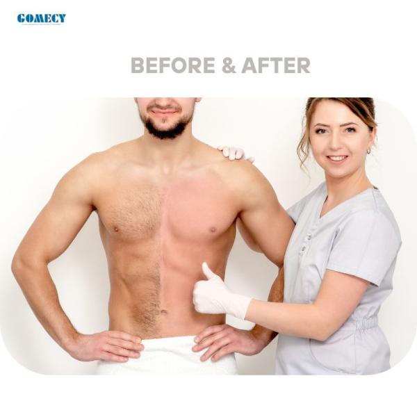 Gomecy Innovative 755nm 808nm 1064nm Diode Laser Hair Removal Machine for All Season Full Body Treatment