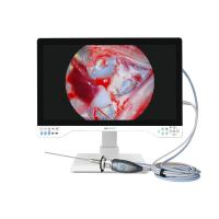 4K All In One Endoscope Camera System Built-in LED Light With 32 Inch Medical Monitor