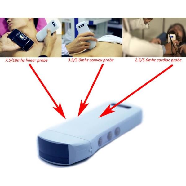 128 Elements Medical Hospital Equipments Color Doppler Portable Wireless Ultrasound Machine 3 In 1