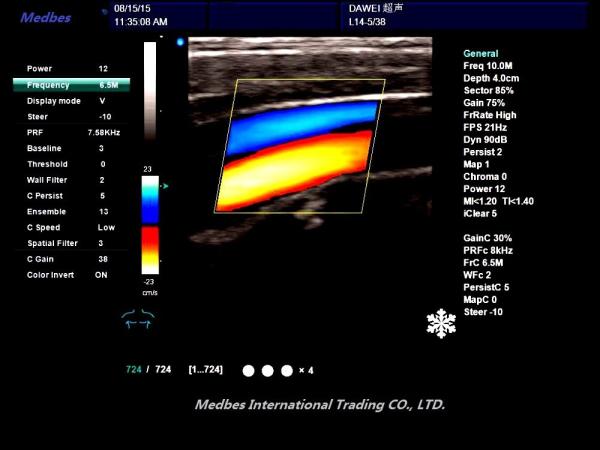 C60 Popular 3D Color Doppler Ultrasound System duplex ultrasound Scanner