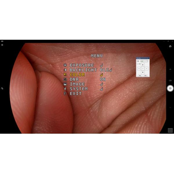 FHD Laptop Computer Camera System Portable Endoscope Camera Use for ENT Surgery