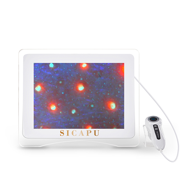 Equipo de prueba de piel de alta definición de 15 pulgadas detecta problemas de la piel con una pantalla nítida