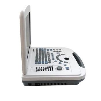 ON SALE!!!  Portable full digital laptop B&W ultrasound scanner for hospital
