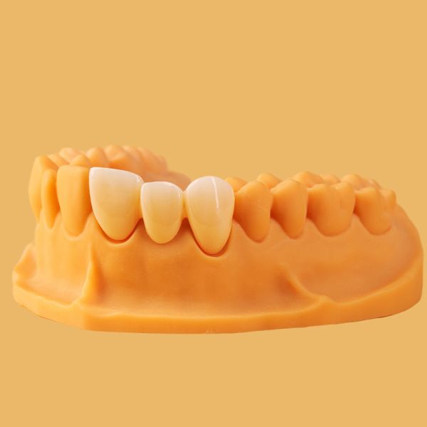 High Strength Dental Zirconia Block 1200MPa for Molar Crown Restoration