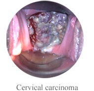 Видеокамера камеры Cervix для влагалищной Handheld собственной личности Colposcope цифров миниой - осмотра с увеличением 1,5 времен