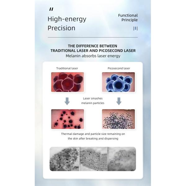 ODM профессиональный q переключил портативную машинку лазера пикосекунды машины удаления татуировки
