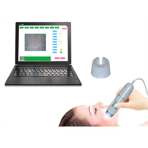 Pocket USB LCD Digital Dermatoscope Skin and Hair Analyzer With Testing Software