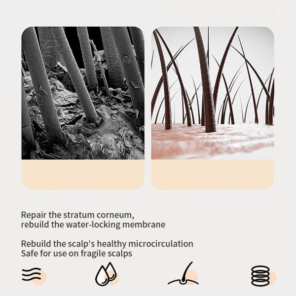 Anti Itching Plant Extract Salicylic Acid Hair Cleans Deep Follicle Cleanser Oil Control Essence