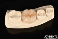 Full Zirconia High Wear Resistance And Strength In Industrial Applications
