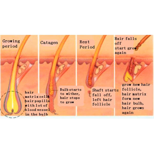 Semiconductor 808 Diode Laser Hair Removal Machine With CE Approved