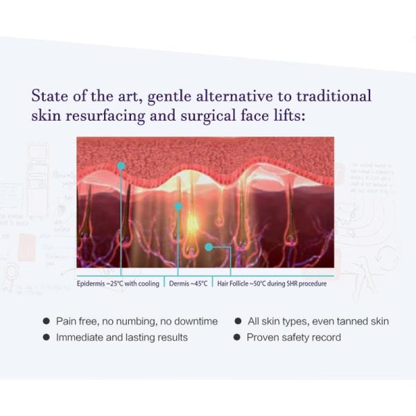 Máquina 755nm permanente 808nm 1064nm del retiro del pelo del laser del diodo de 3 ondas