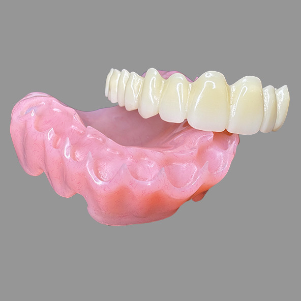 CAD/CAM Digital Milled Acrylic Base Denture Removable