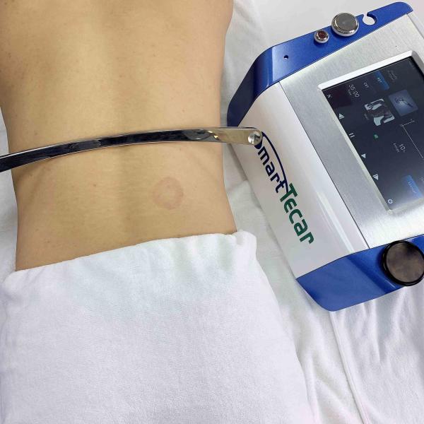 Pysiotherapy 300KHZ And 448KHZ 10.4'' Tecar Therapy Machine Athletic Rehabilitation