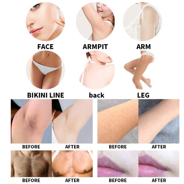 2 в 1 многофункциональный лазерный пикосекундный удаление татуировки Nd Yag и 808nm диодный удаление волос Пико лазерная машина